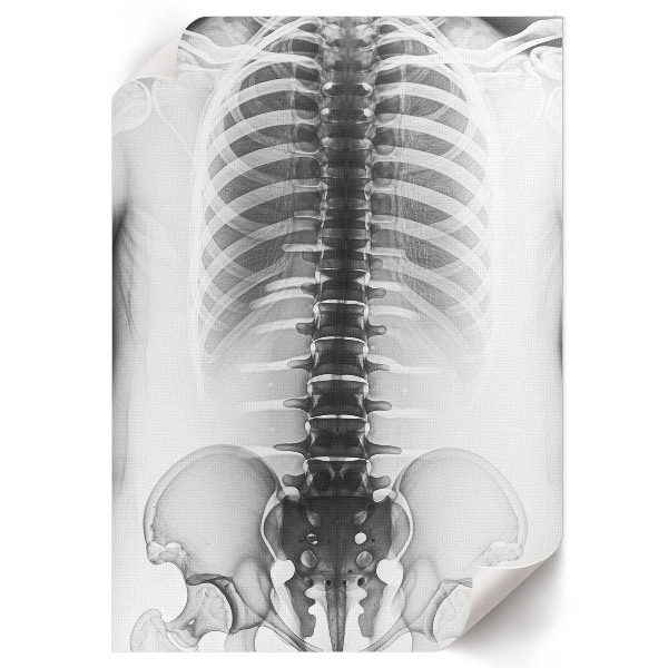 Retro plakát rentgen