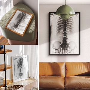 Retro plakát rentgen